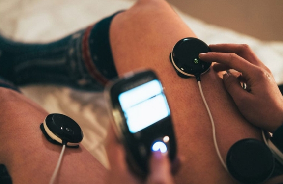 Electrostimulation